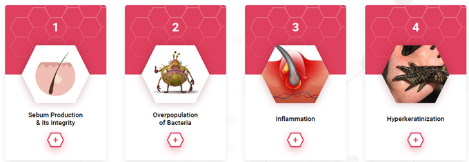 Table showing the 4 factors involved in acne which Bakuchiol is effective on.