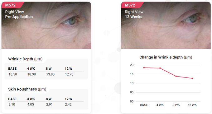 Photos showing the skin's improvement when using Bakuchiol over 12 weeks - right face view.